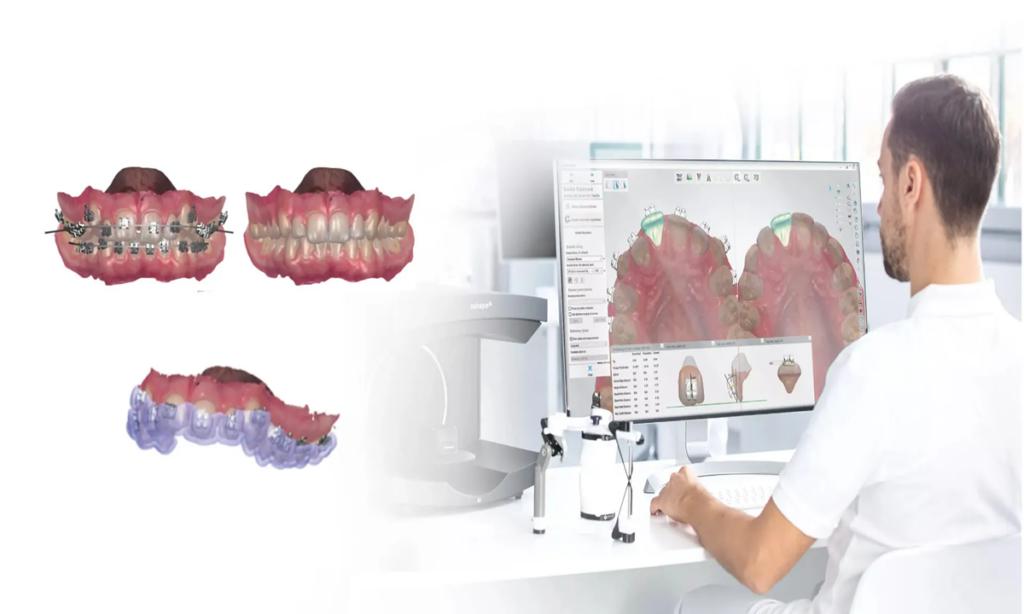 متخصص ارتودنسی در حال قالب گیری دیجیتال